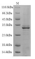 The SDS-PAGE of Recombinant Human CD19